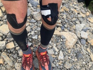 Don’t wear shorts in Jackpine valley or this is what your knees will look like afterwards! Luckily my only ‘stupid light’ gear choice of the trip.